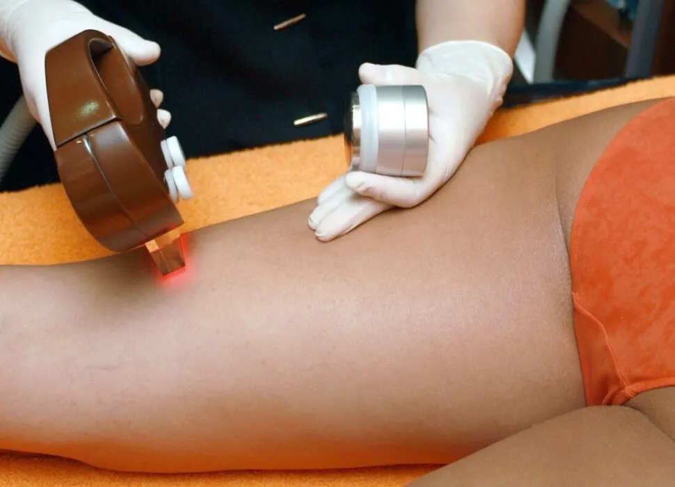 Épilation_laser_:_un_traitement_efficace_et_rapide